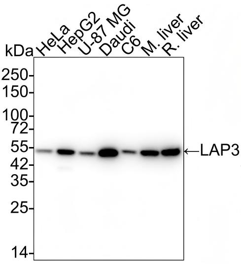 LAP3 Antibody (PSH01-26) Western Blot: LAP3 Antibody (PSH01-26) [NBP3-32525]