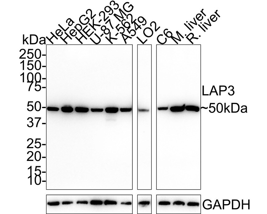 LAP3 Antibody (PSH01-26) Western Blot: LAP3 Antibody (PSH01-26) [NBP3-32525]