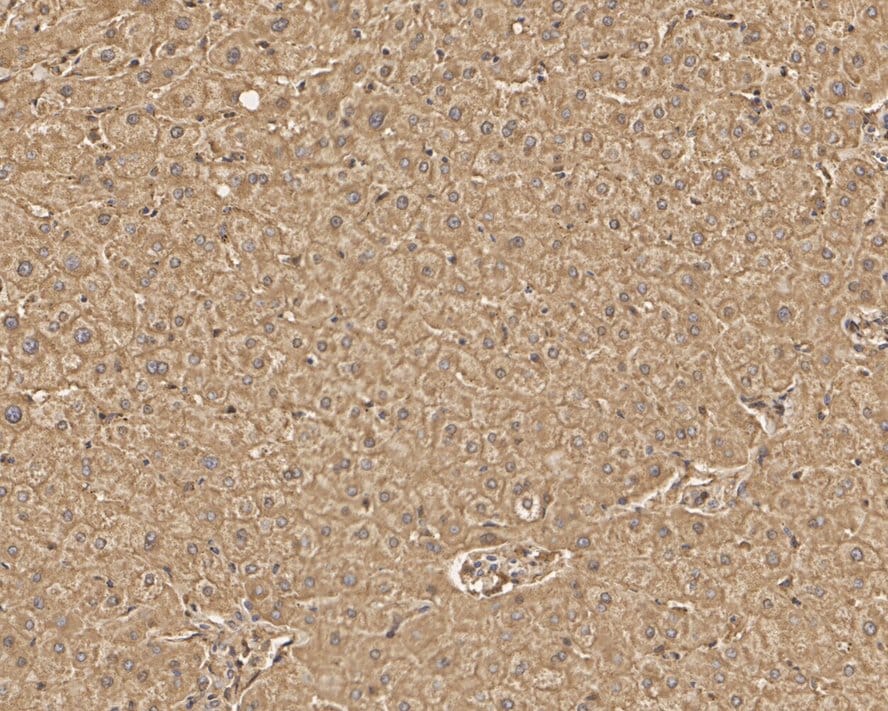 LAP3 Antibody (PSH01-26)