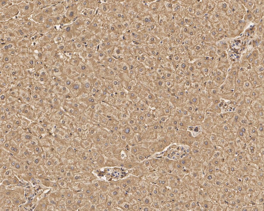 LAP3 Antibody (PSH01-34)