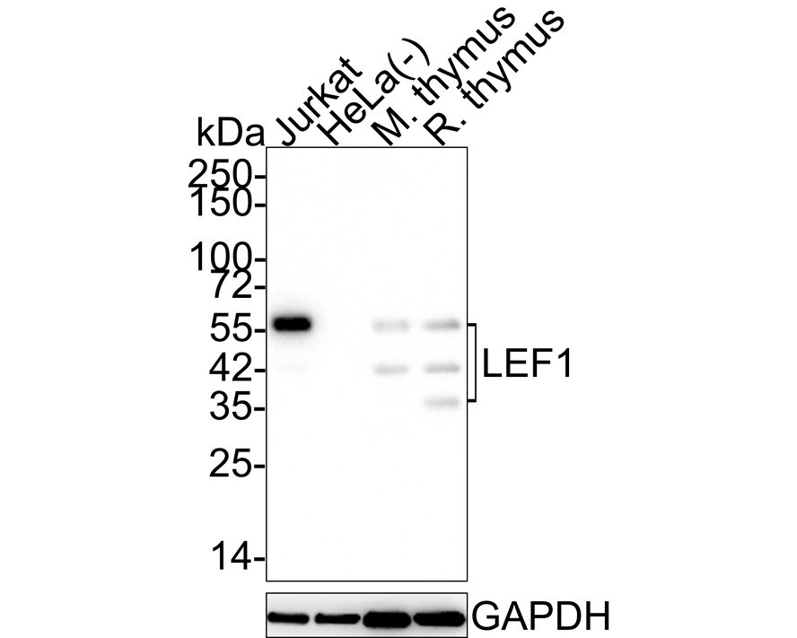 LEF1 Antibody (JE52-28) Western Blot: LEF1 Antibody (JE52-28) [NBP3-32527]