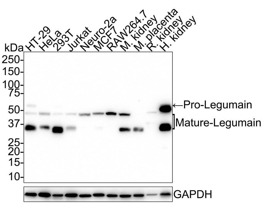 Legumain/Asparaginyl Endopeptidase Antibody (JE35-56) Western Blot: Legumain/Asparaginyl Endopeptidase Antibody (JE35-56) [NBP3-32528]