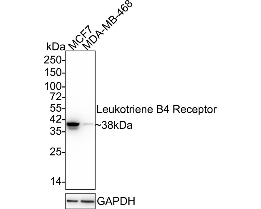 Leukotriene B4 R1 Antibody (JE58-77) Western Blot: Leukotriene B4 R1 Antibody (JE58-77) [NBP3-32529]