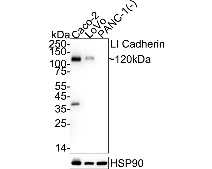Cadherin-17 Antibody (PD00-49) Western Blot: Cadherin-17 Antibody (PD00-49) [NBP3-32534]