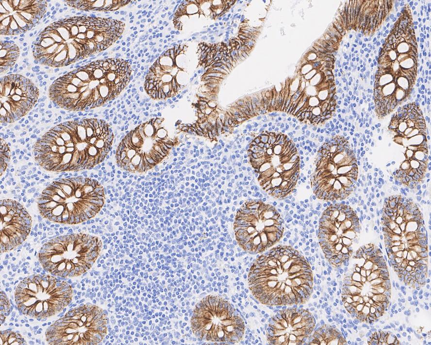 Cadherin-17 Antibody (PD00-49)