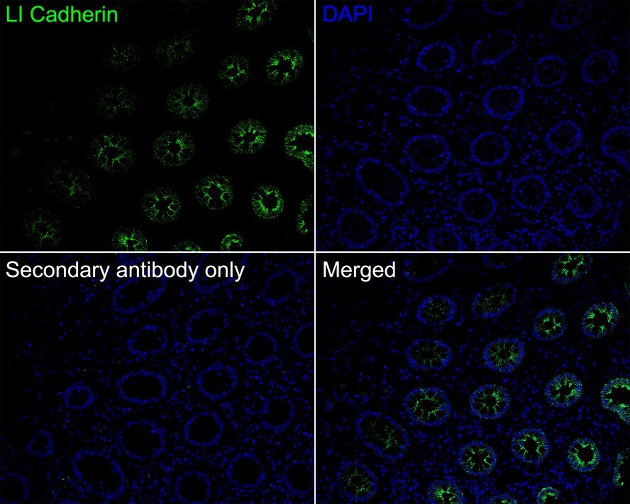Cadherin-17 Antibody (PD00-49)