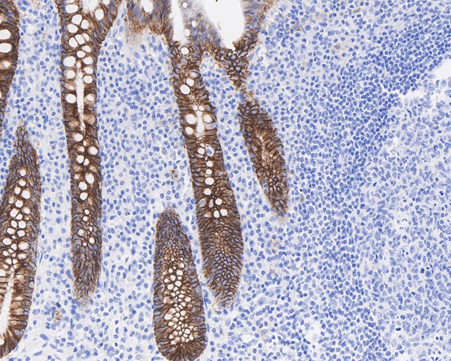 Cadherin-17 Antibody (JE60-34)