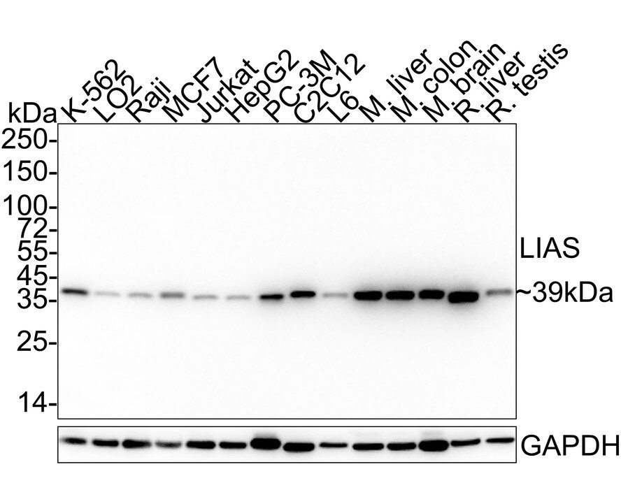 LIAS Antibody (PSH04-04) Western Blot: LIAS Antibody (PSH04-04) [NBP3-32536]