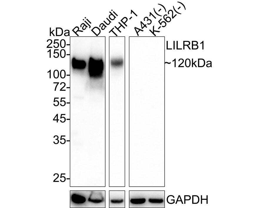 ILT2/CD85j/LILRB1 Antibody (PSH04-59) Western Blot: ILT2/CD85j/LILRB1 Antibody (PSH04-59) [NBP3-32537]