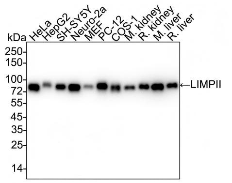 LIMPII/SR-B2 Antibody (PSH03-25) Western Blot: LIMPII/SR-B2 Antibody (PSH03-25) [NBP3-32538]