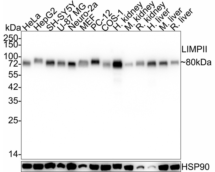 LIMPII/SR-B2 Antibody (PSH03-25) Western Blot: LIMPII/SR-B2 Antibody (PSH03-25) [NBP3-32538]