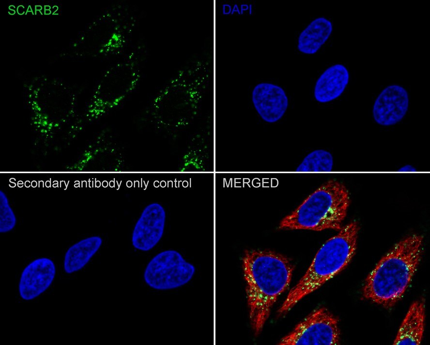 LIMPII/SR-B2 Antibody (PSH03-25)