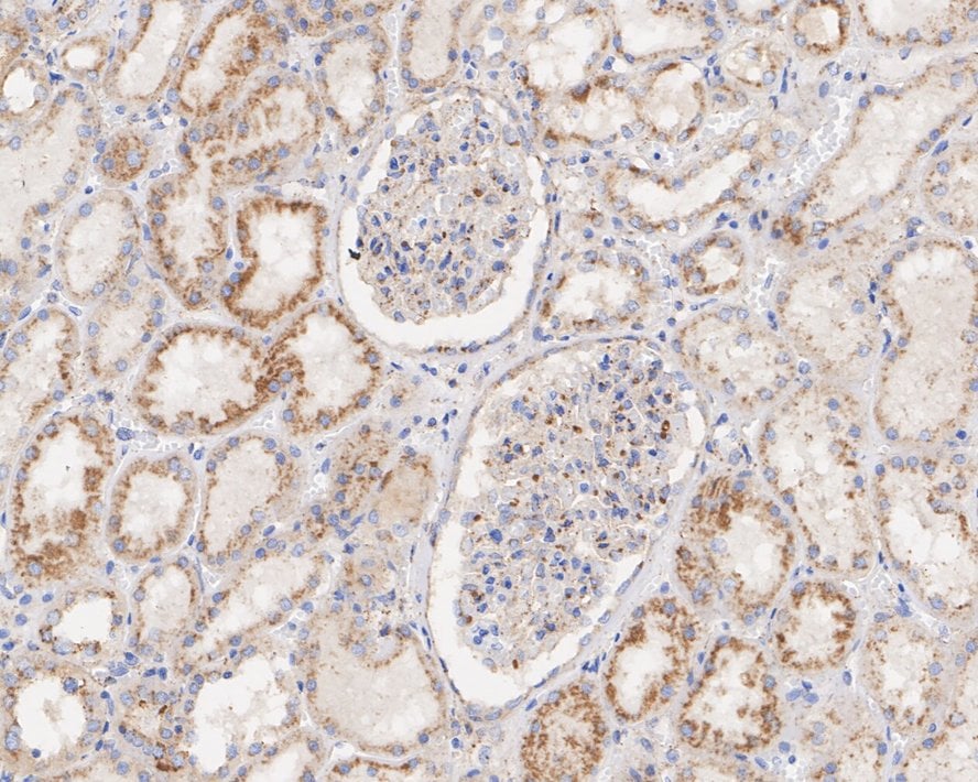 LIMPII/SR-B2 Antibody (PSH03-25)