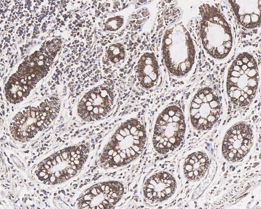 Dihydrolipoamide Dehydrogenase/DLD Antibody (PSH0-83)