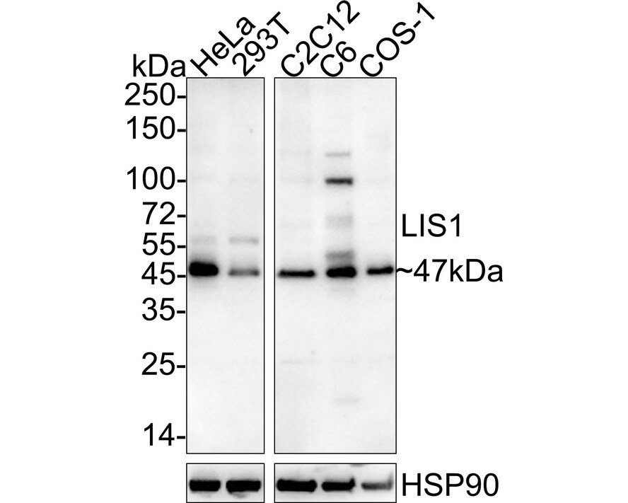 LIS1 Antibody (JE37-43) Western Blot: LIS1 Antibody (JE37-43) [NBP3-32540]