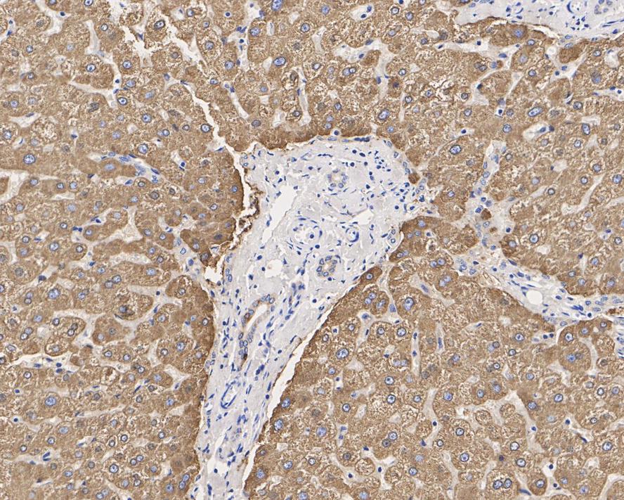 Carboxylesterase 1/CES1 Antibody (JE33-04)