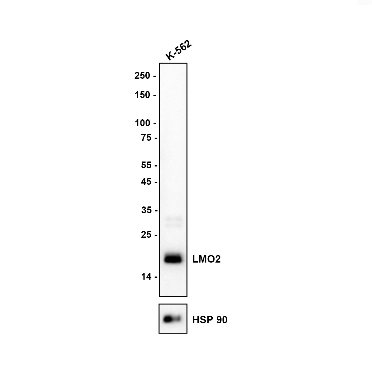 LMO2 Antibody (PD00-25) Western Blot: LMO2 Antibody (PD00-25) [NBP3-32542]