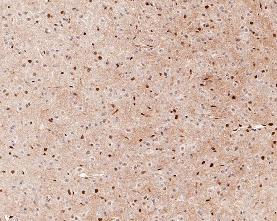 LMO2 Antibody (PD00-25)