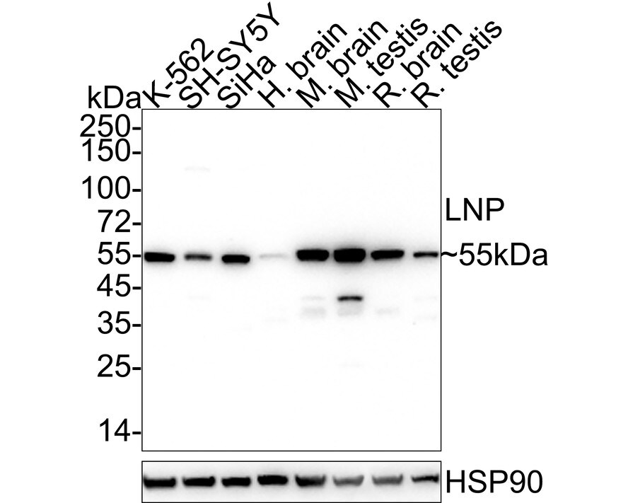 Lunapark Antibody (11-1-R) Western Blot: Lunapark Antibody (11-1-R) [NBP3-32543]