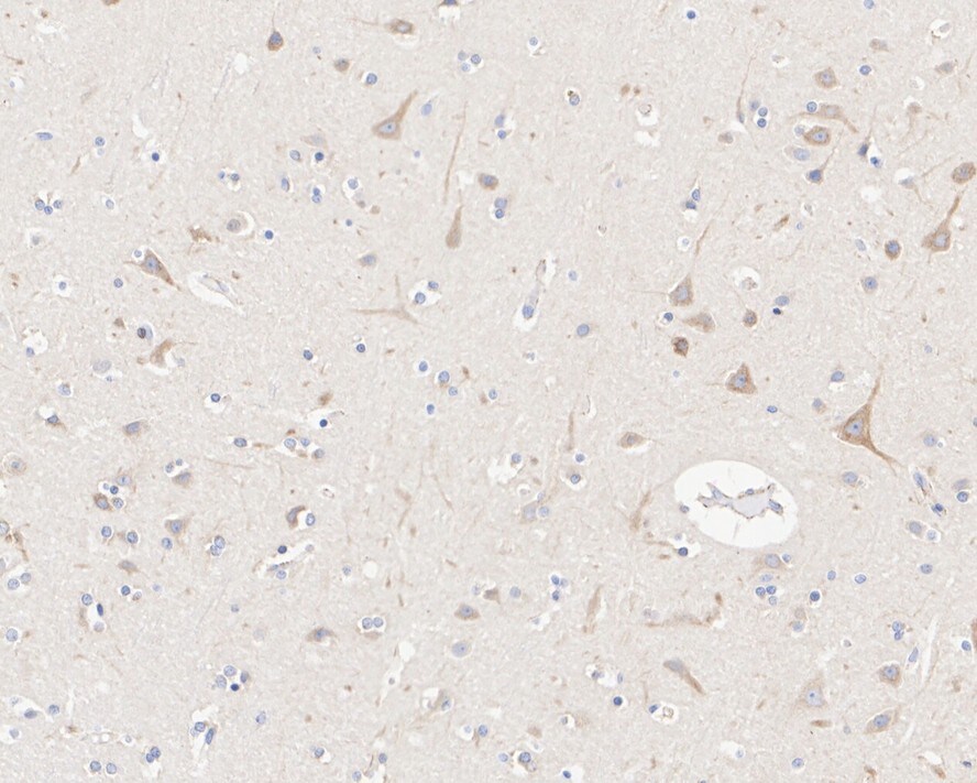 Lunapark Antibody (11-1-R)