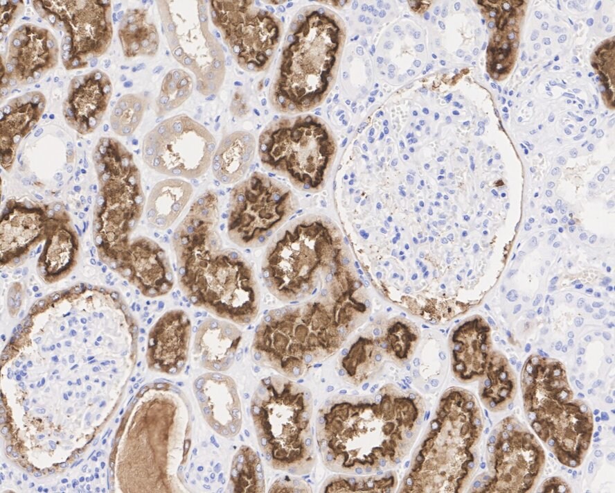 LRP2 Antibody (PSH04-52)