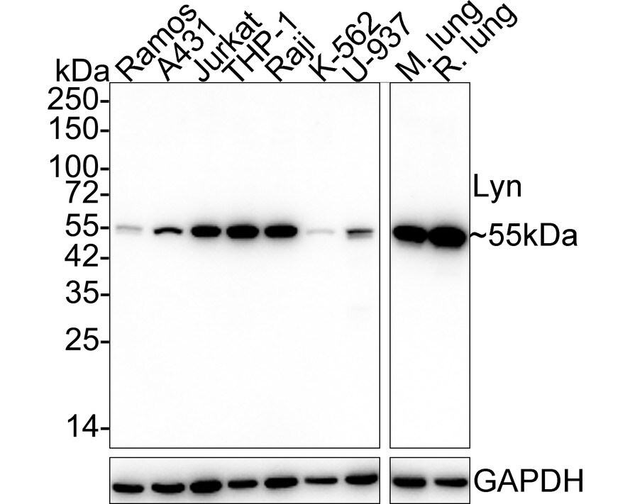 Lyn Antibody (JE44-75) Western Blot: Lyn Antibody (JE44-75) [NBP3-32549]