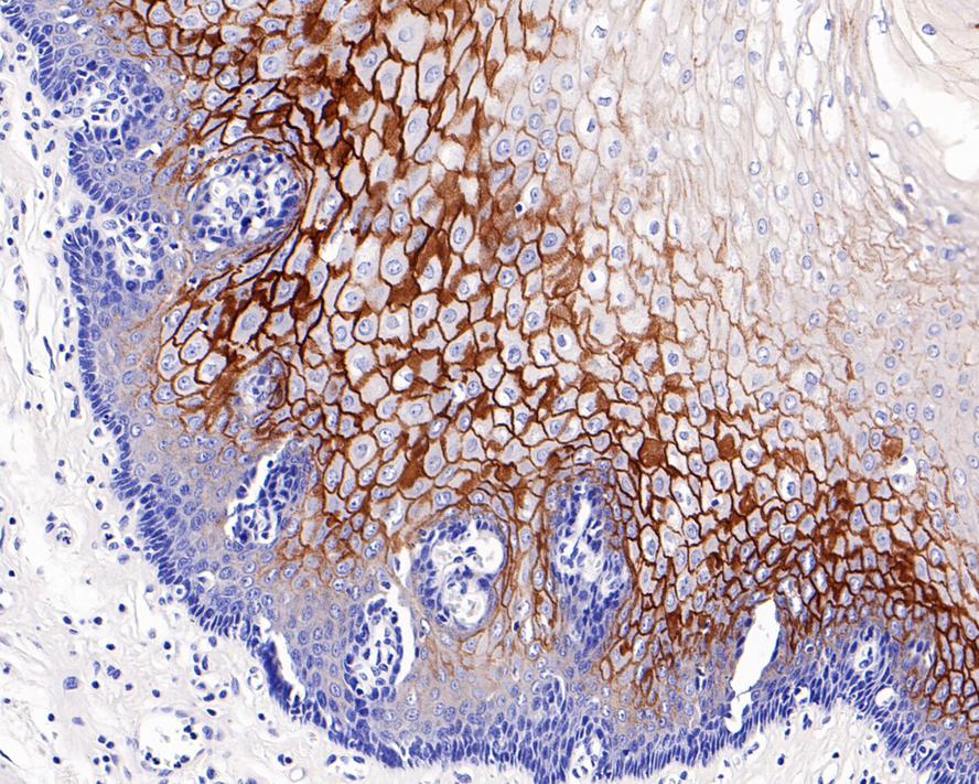 C4.4A/LYPD3 Antibody (PS00-59)