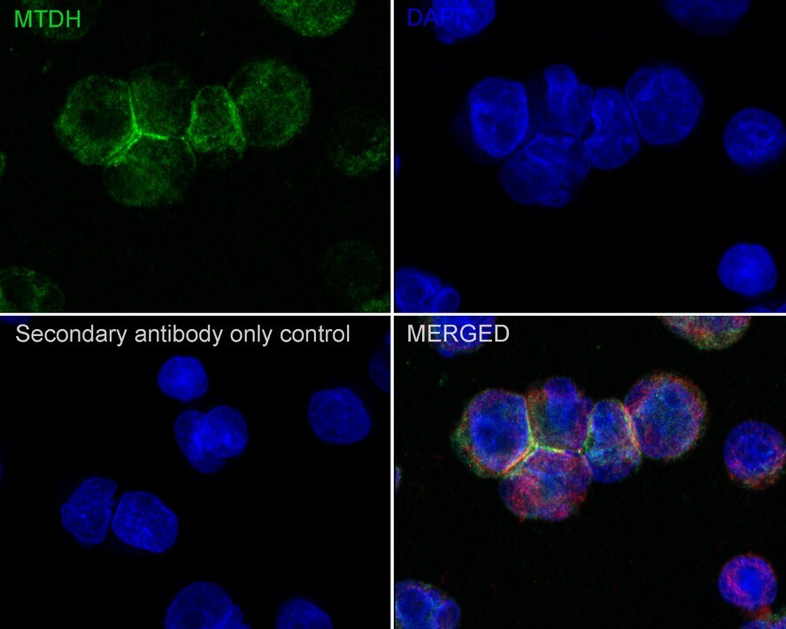 Metadherin Antibody (C6-C10-R)