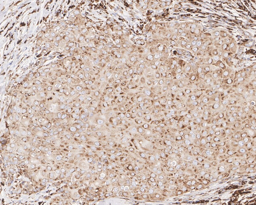 Metadherin Antibody (C6-C10-R)