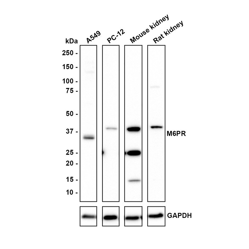 CD-M6PR Antibody (PSH01-06) Western Blot: CD-M6PR Antibody (PSH01-06) [NBP3-32555]