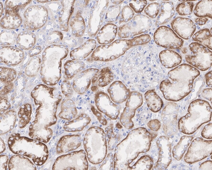 CD-M6PR Antibody (PSH01-06)