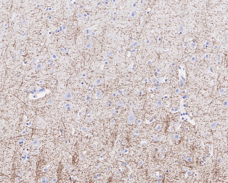 MAG/Siglec-4a Antibody (PSH02-41)