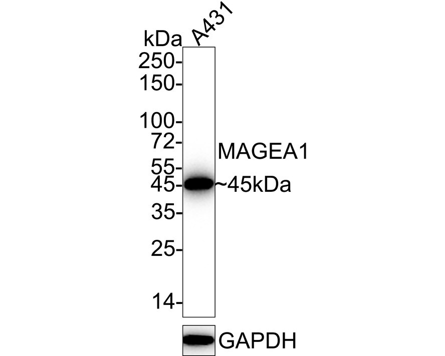 MAGEA1 Antibody (PD00-50) Western Blot: MAGEA1 Antibody (PD00-50) [NBP3-32559]