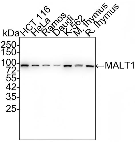 MALT1 Antibody (PSH02-31) Western Blot: MALT1 Antibody (PSH02-31) [NBP3-32561]