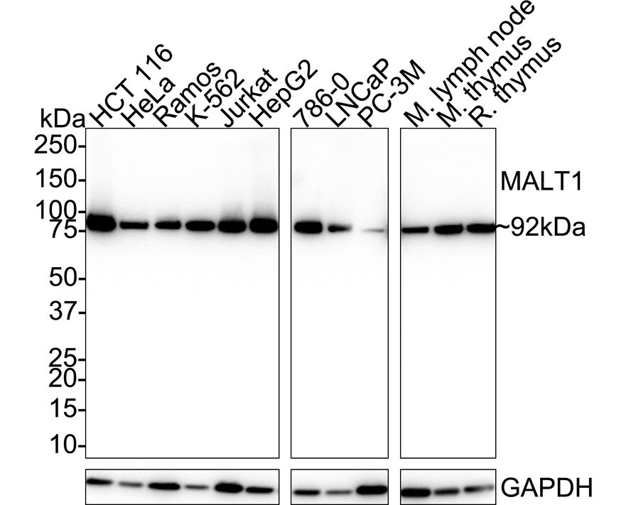 MALT1 Antibody (PSH02-31) Western Blot: MALT1 Antibody (PSH02-31) [NBP3-32561]