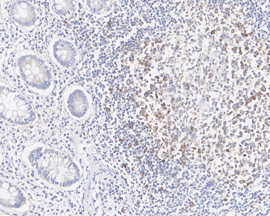 MALT1 Antibody (PSH02-31)