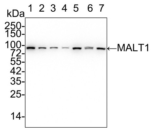 MALT1 Antibody (PSH02-31)