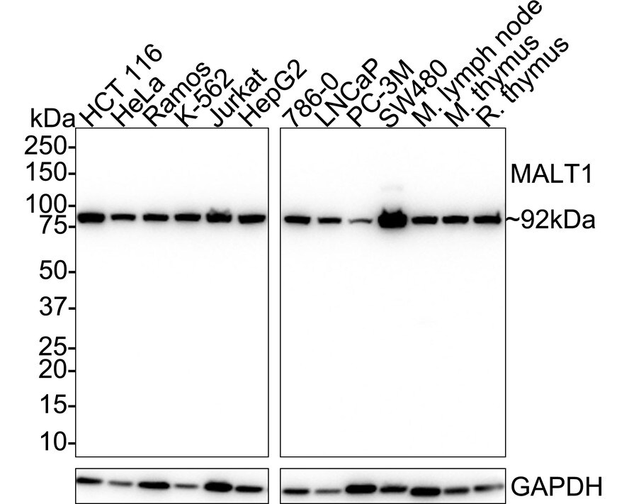 MALT1 Antibody (PSH02-32) Western Blot: MALT1 Antibody (PSH02-32) [NBP3-32562]