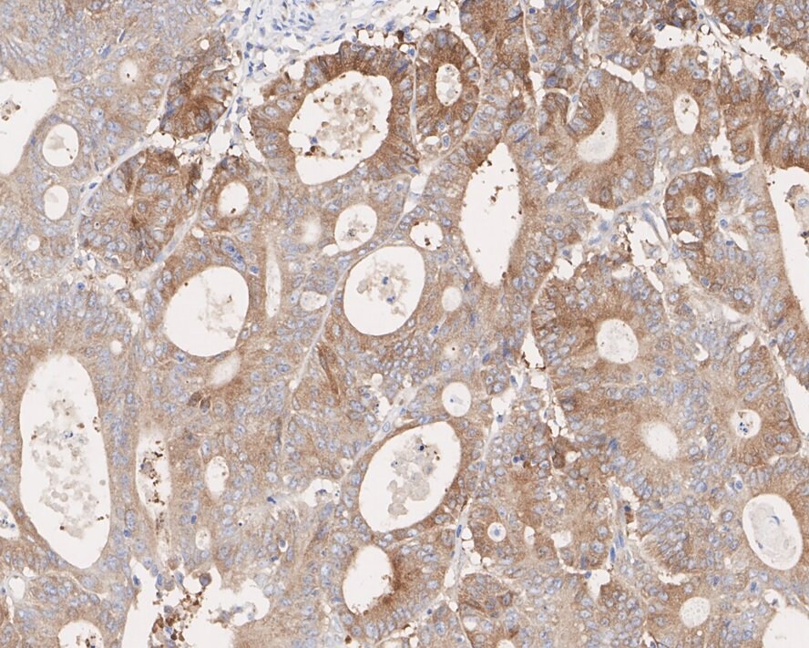MALT1 Antibody (PSH02-32)