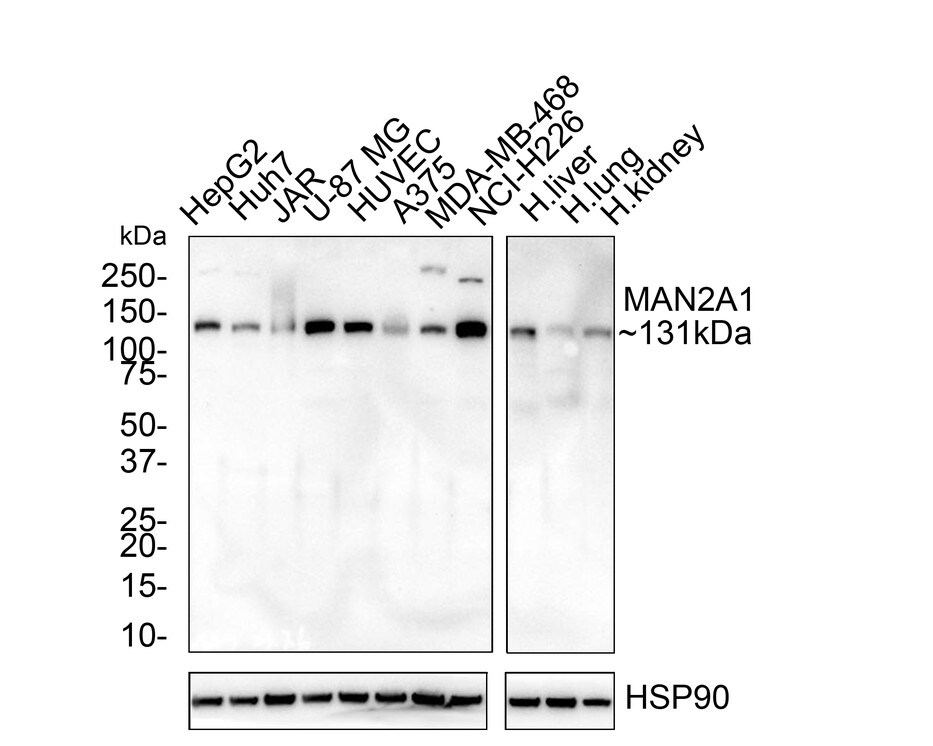 Alpha-mannosidase II Antibody (PSH02-67) Western Blot: Alpha-mannosidase II Antibody (PSH02-67) [NBP3-32565]