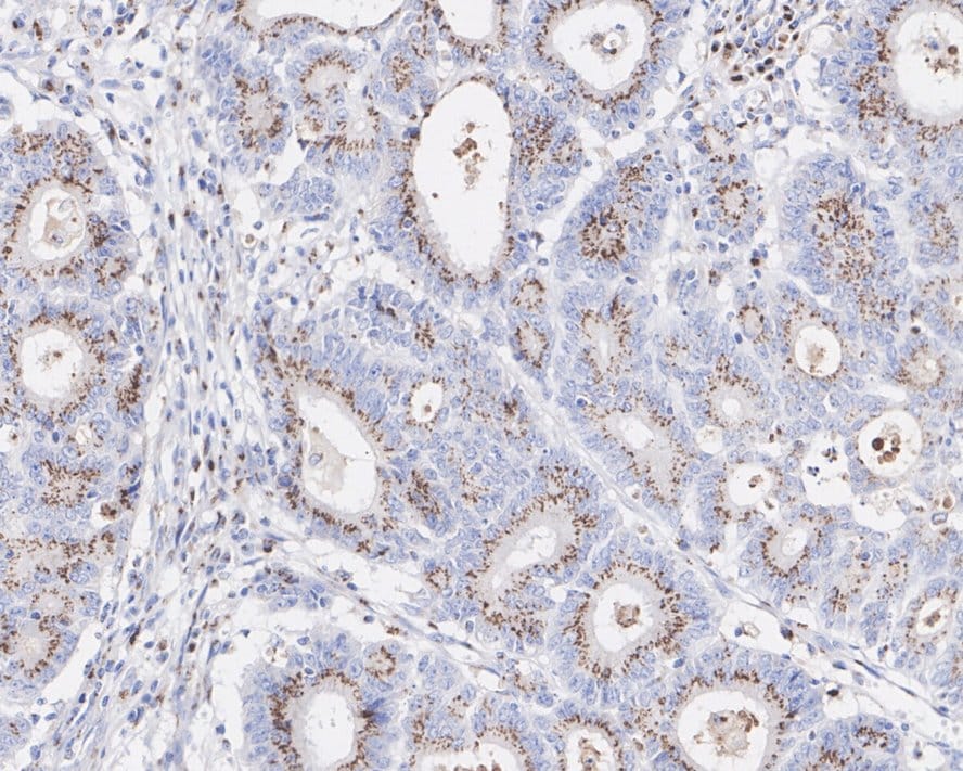 Alpha-mannosidase II Antibody (PSH02-67)