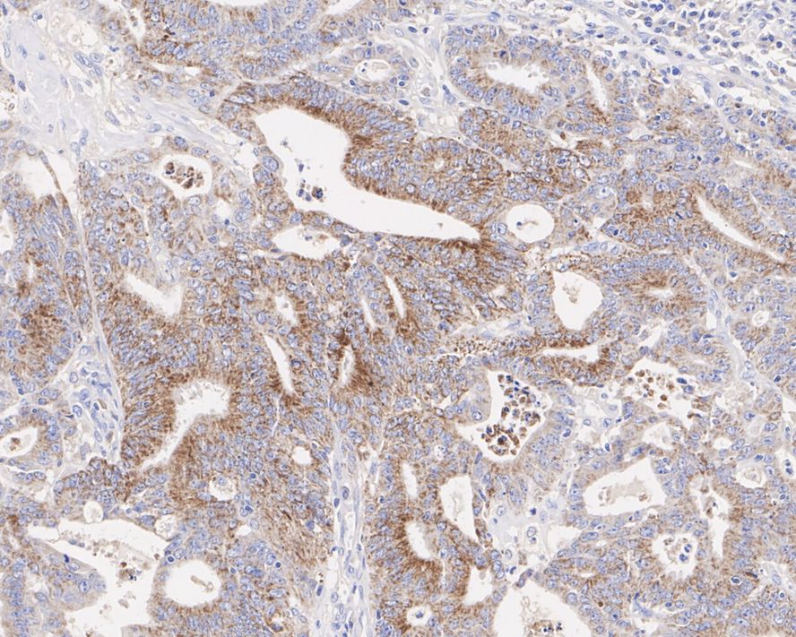 MAO-A Antibody (5D1-R)