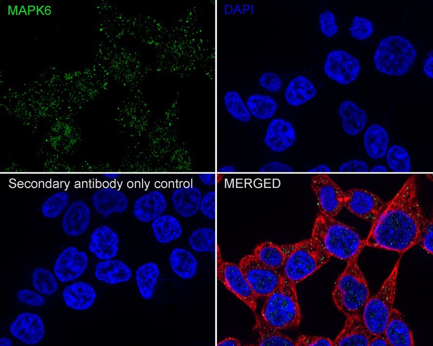 ERK3/MAPK6 Antibody (PSH03-39)