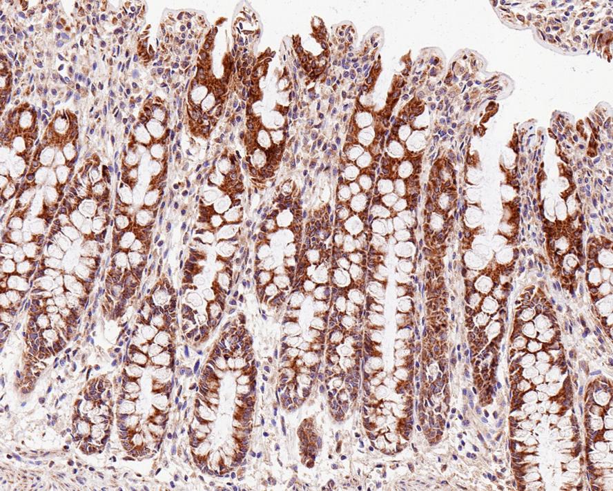MAVS Antibody (PSH0-30)