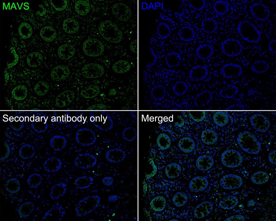 MAVS Antibody (PSH01-65)