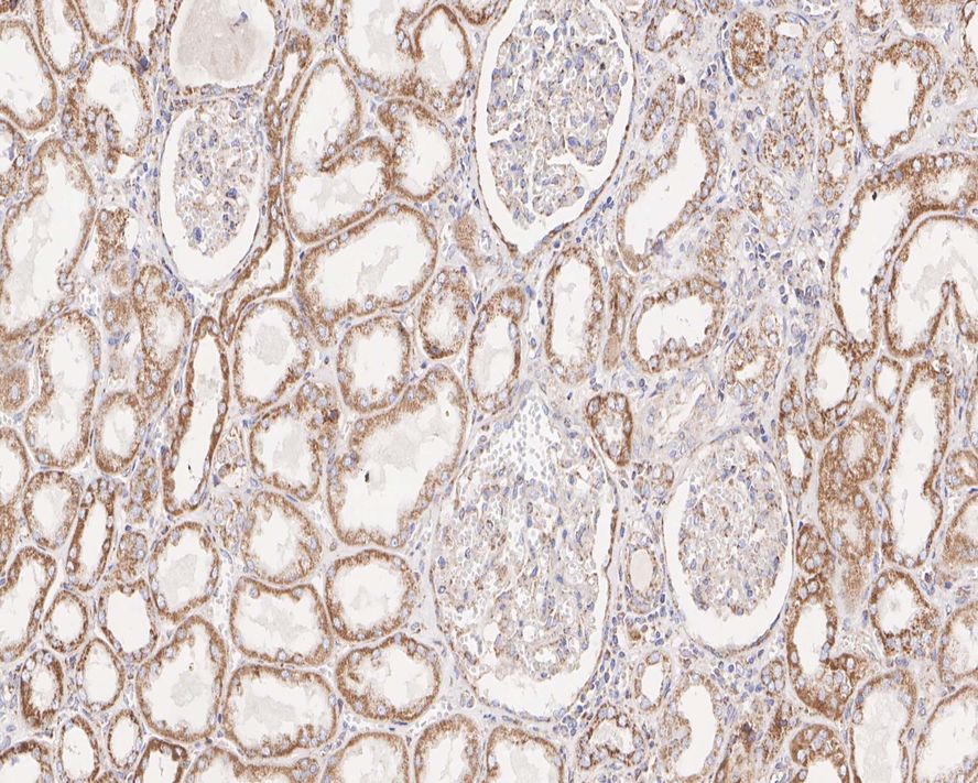 MAVS Antibody (PSH01-65)