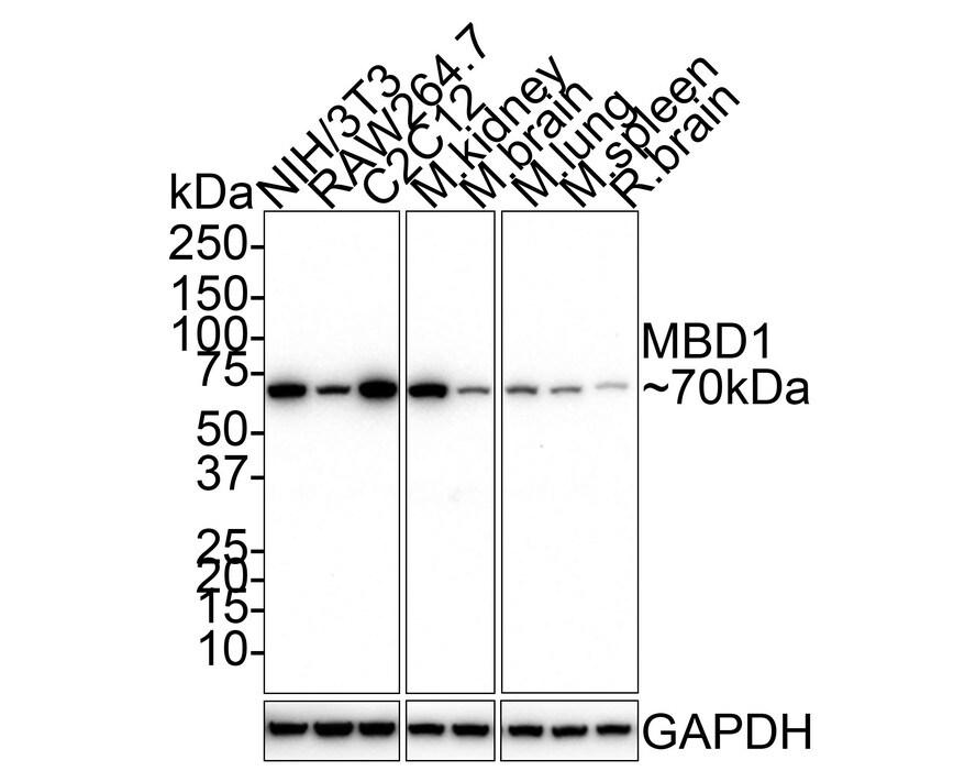 MBD1 Antibody (PSH01-79) Western Blot: MBD1 Antibody (PSH01-79) [NBP3-32571]