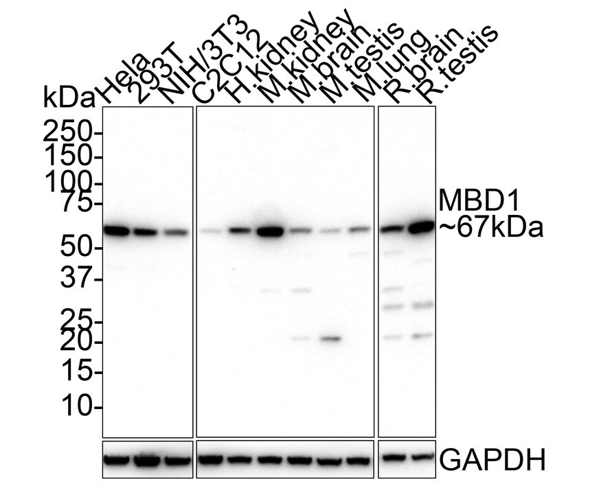 MBD1 Antibody (PSH01-78) Western Blot: MBD1 Antibody (PSH01-78) [NBP3-32572]