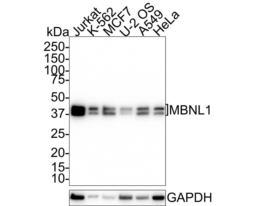 Muscleblind-like 1 Antibody (JE38-34) Western Blot: Muscleblind-like 1 Antibody (JE38-34) [NBP3-32573]
