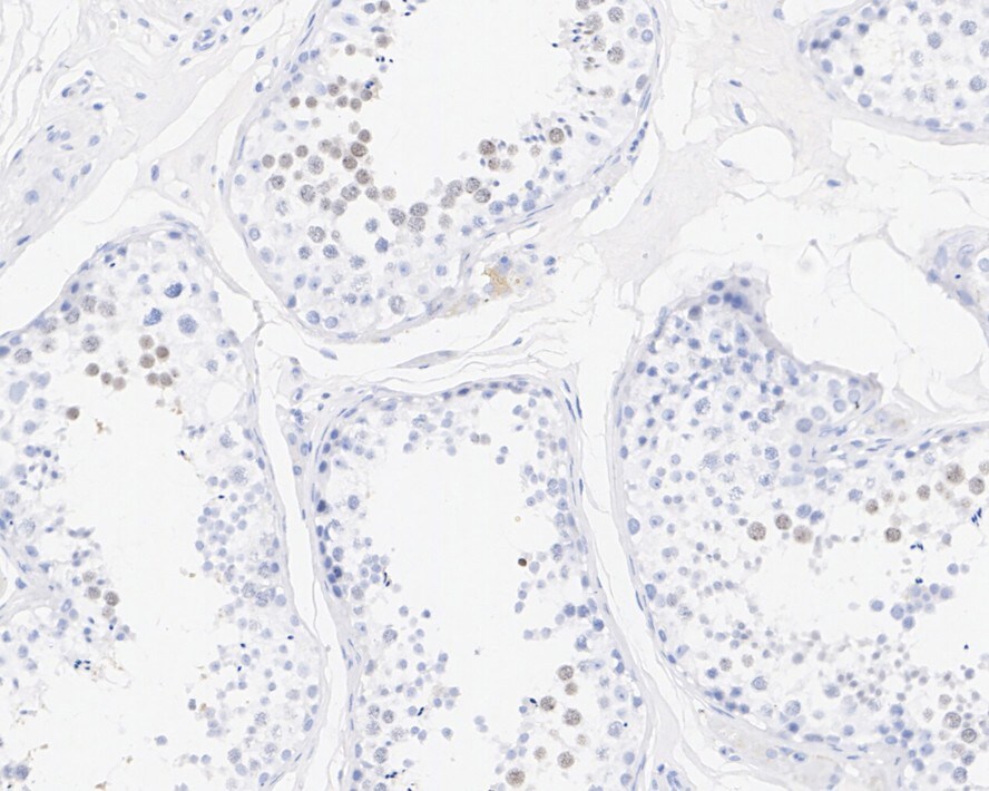 KIF2C Antibody (PSH01-51)